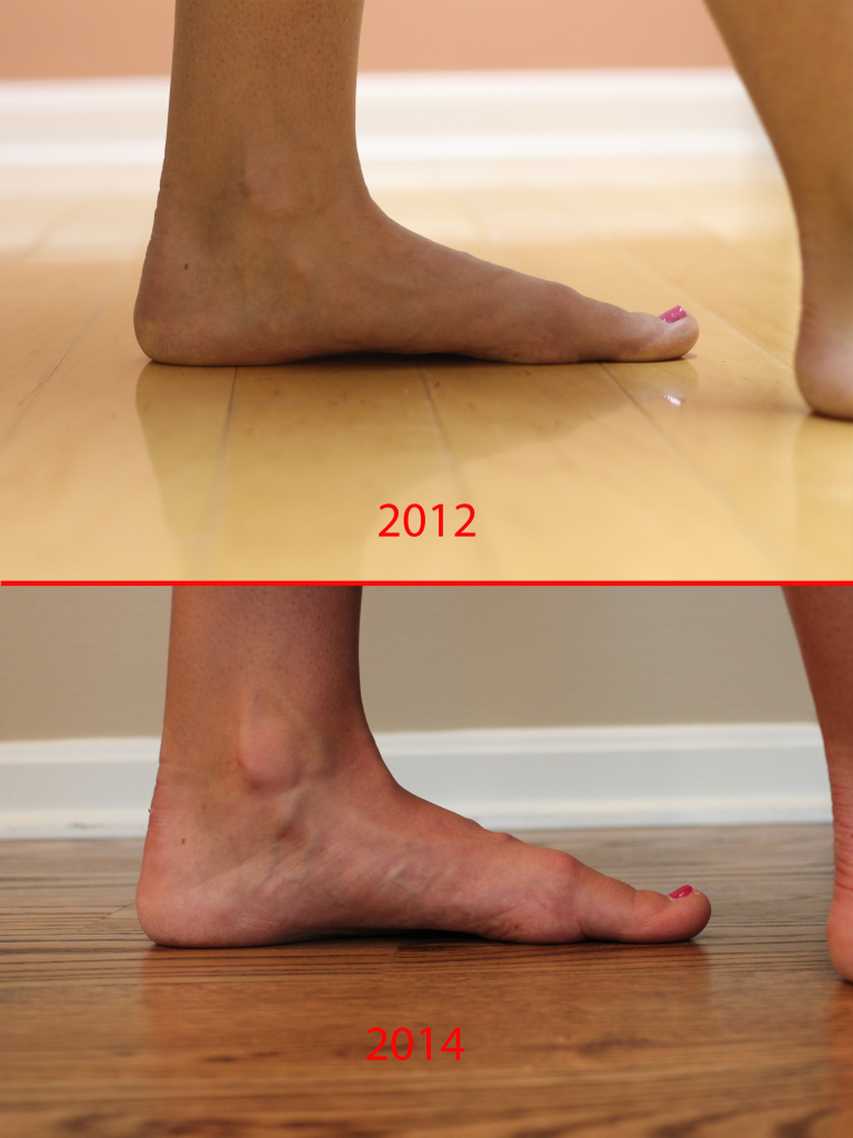 Barefoot or Minimalist Shoe Running