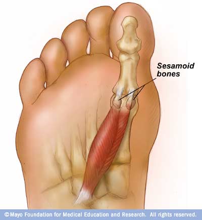 Notice how the sesamoid bones are intratendonous (within the tendon) with the Flexor hallucis brevis.